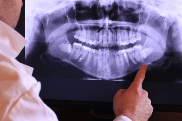 Best Broken Tooth Emergency  in Renova, MS