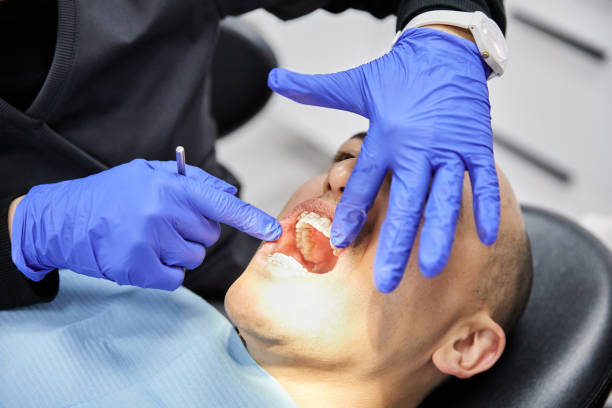 Best Emergency Dental Filling Replacement  in Renova, MS